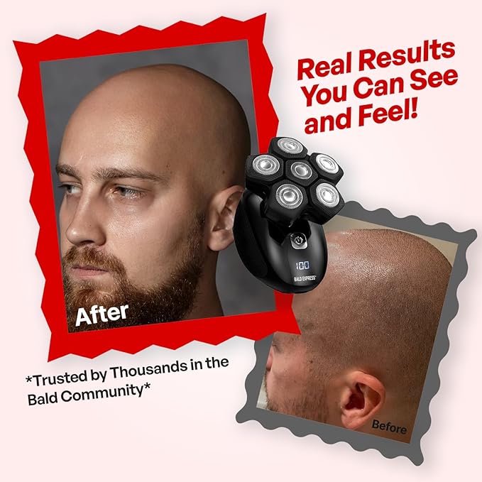 Bald Express