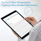 Checkme DuoEK ER2، دستگاه نوار قلب قابل حمل، ECG پرتابل، مانیتور قلب خانگی، الکتروکاردیوگرام جیبی، نوار قلب انگشتی، دستگاه پایش قلب، مانیتور ECG بلوتوثی، نوار قلب بلوتوثی، تحلیل آریتمی، دستگاه HRV خانگی، نوار قلب بدون سیم، دستگاه نوار قلب با اپلیکیشن