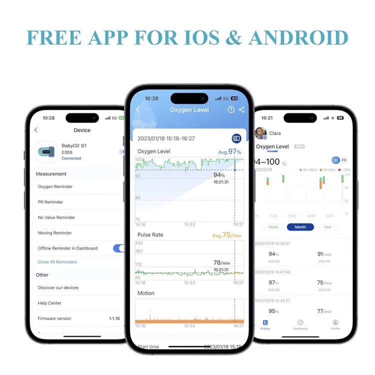 BabyO2 oxygen monitor