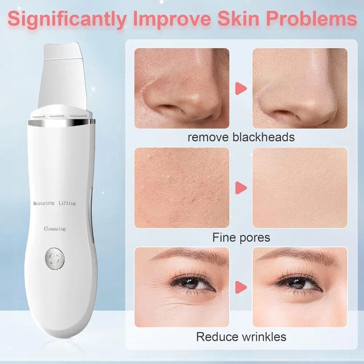 دستگاه اولتراسونیک پوست