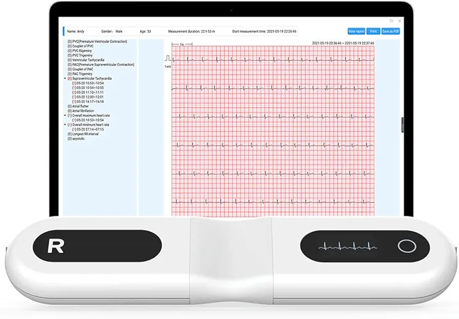 دستگاه نوار قلب  Wellue®