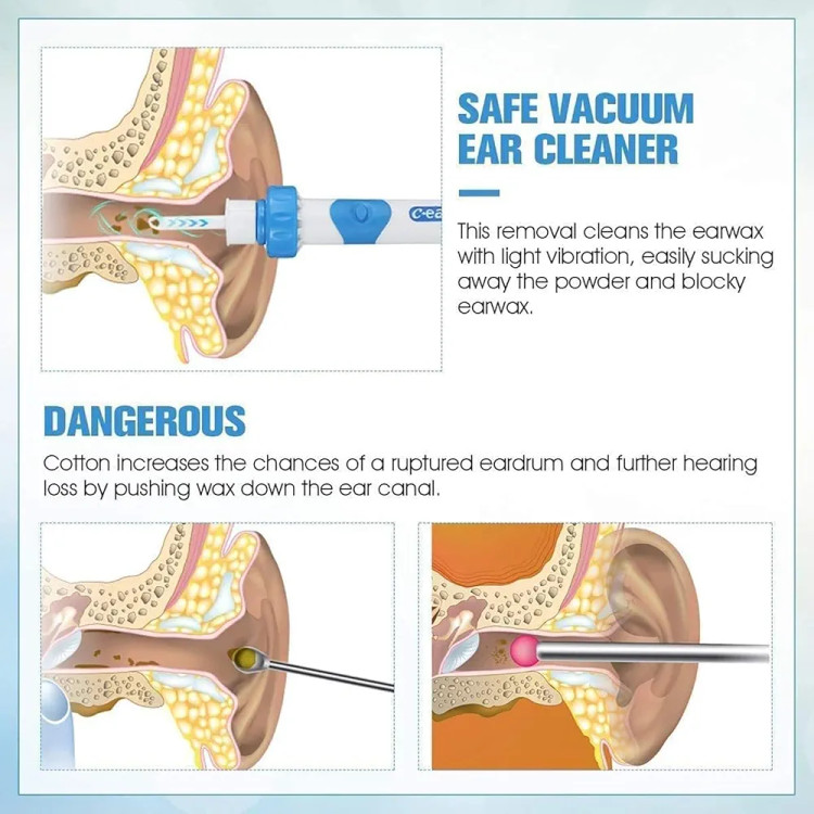 گوشپاککن حرفهای