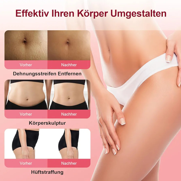 دستگاه ضد سلولیت برقی